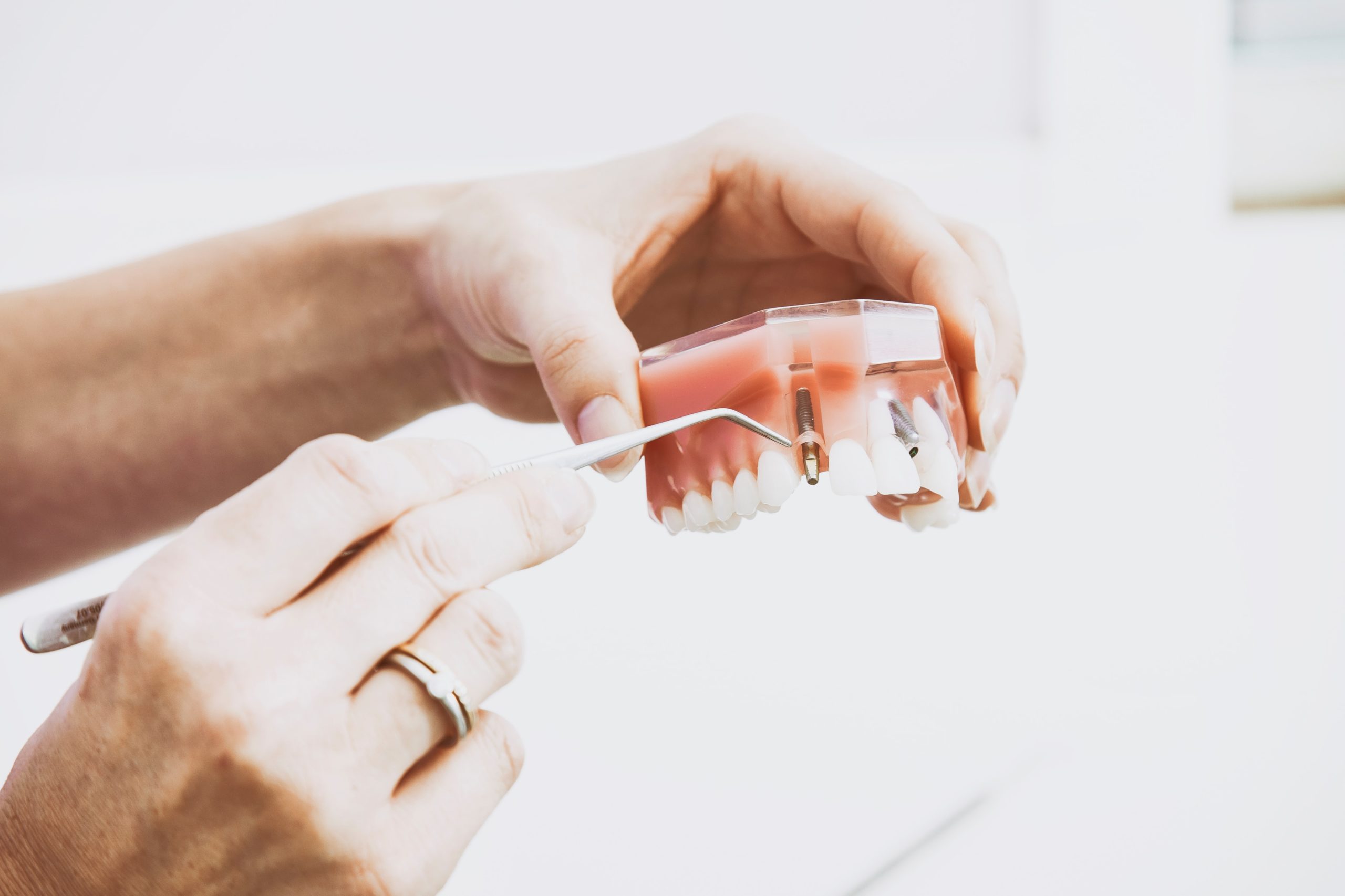 A person holding dentures, representing a sales rep for a dental supply company